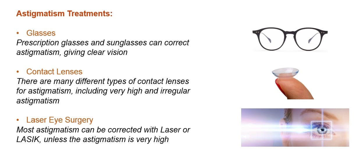 Astigmatism: Symptoms, Tests & Treatment