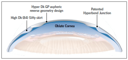 Hybrid contact lens.