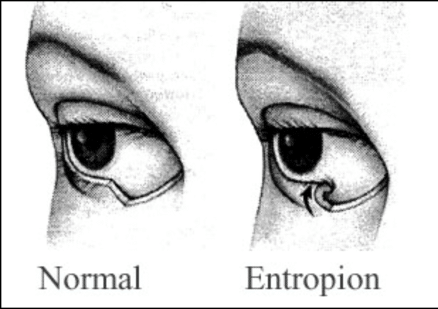 Entropian.