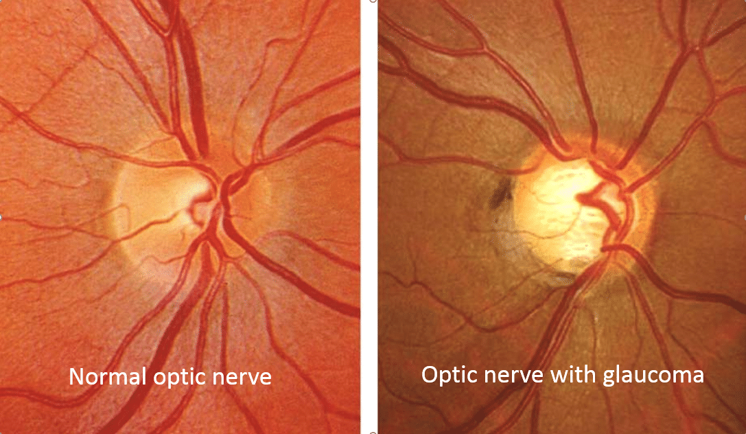 Your eye test for The Eye Practice
