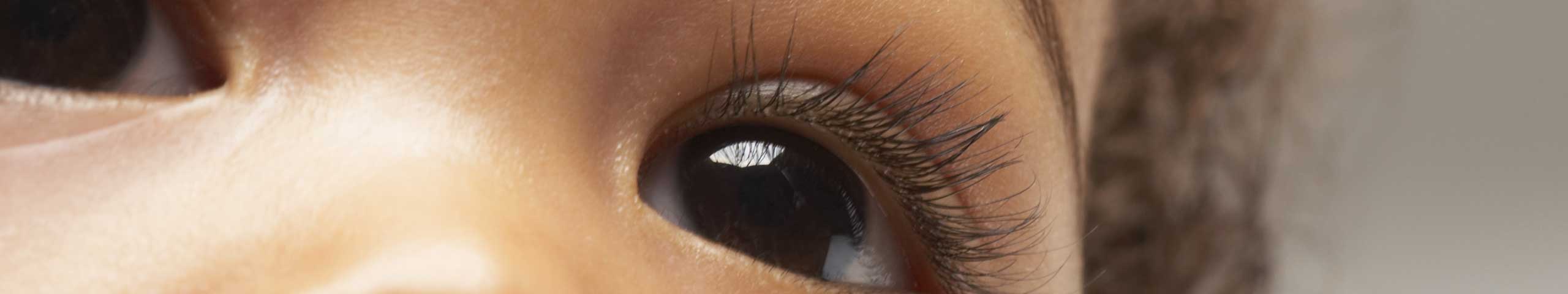 Coloboma.