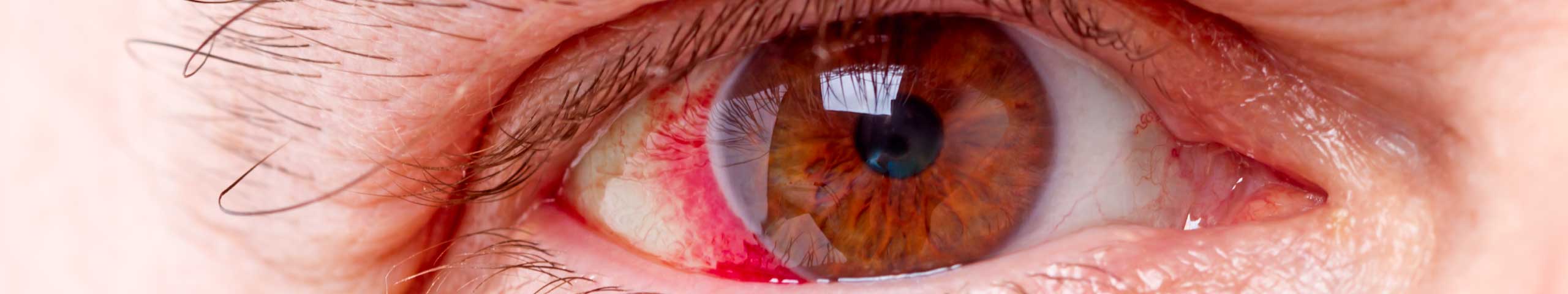Red eyes.