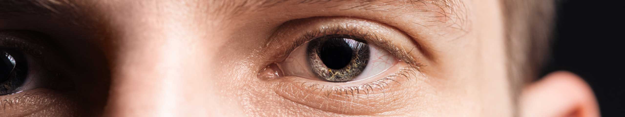 Is there a cure for keratoconus?