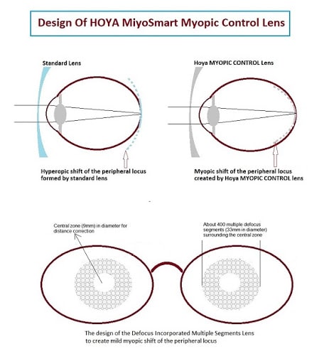 How does MiyoSmart work?