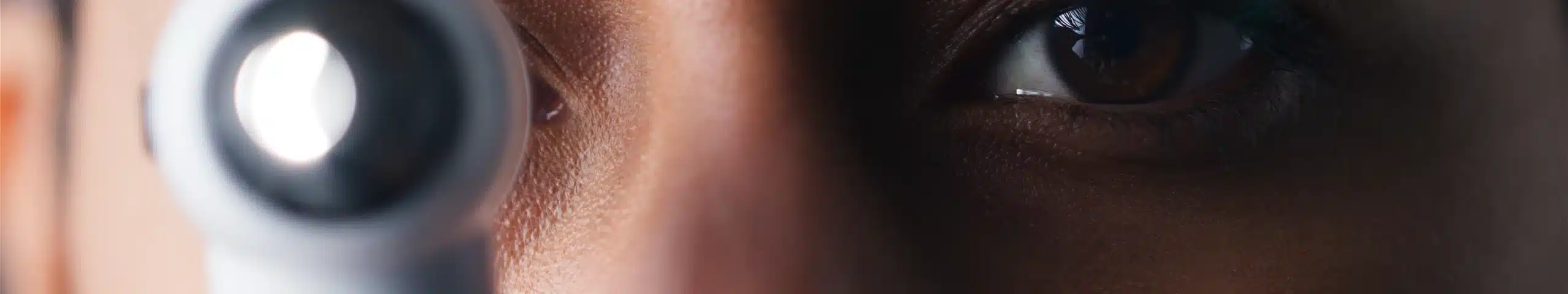 Close-up portrait of a cataract eye test.