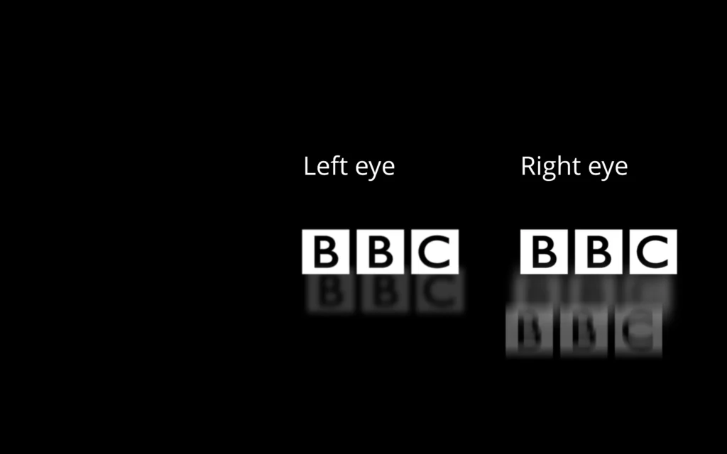 The BBC logo as seen by someone suffering keratoconus.