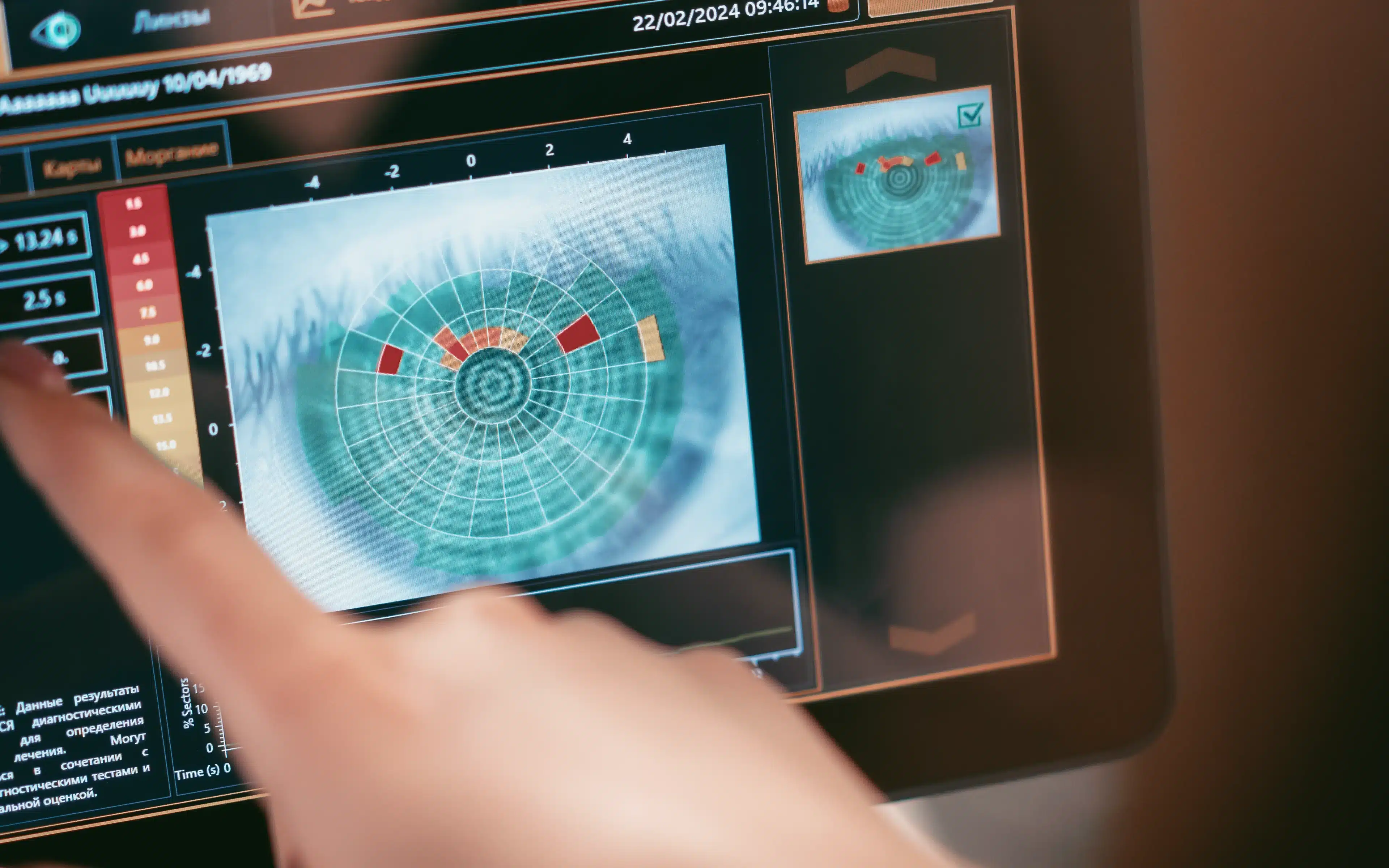 Close-up of diagnostic screen with an image of the eye indicator of moisture and dry areas.